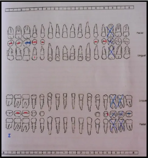 Figura 7. Odontograma 