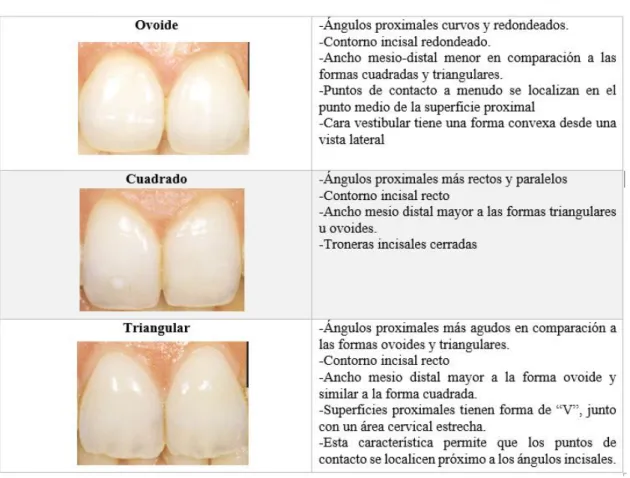 Ilustración 7. Tipos de formas dentales 