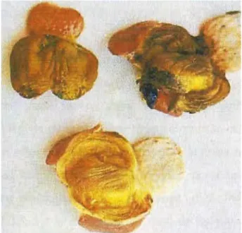 Figura 3  Ulcera de molleja 
