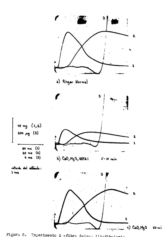 Figura  8 .   ?x,&gt;erimento  2  - f i b r a   Única:  iliofibularis- 