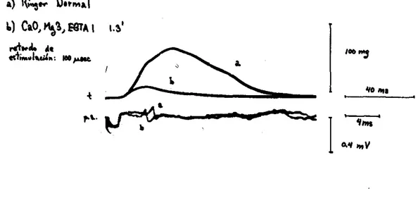 Figura  10.  Experiiuento  16  - f i b r a   Única:  semitendinosus,  80  urn  de 