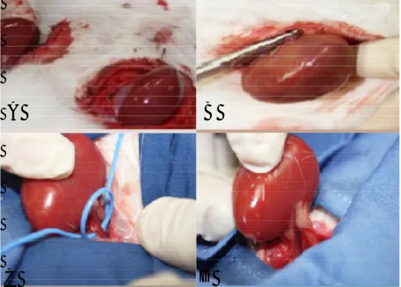 Figura  N°7:  (A)  Identificación  de  ambos  riñones.  (B)  Nefrectomía  de  riñon  derecho