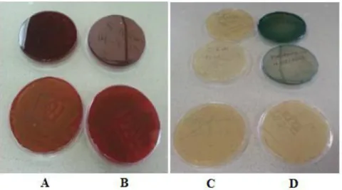 Figura  6 Cultivo de Bacterias en Estudio. A. Staphylococcus sp B.