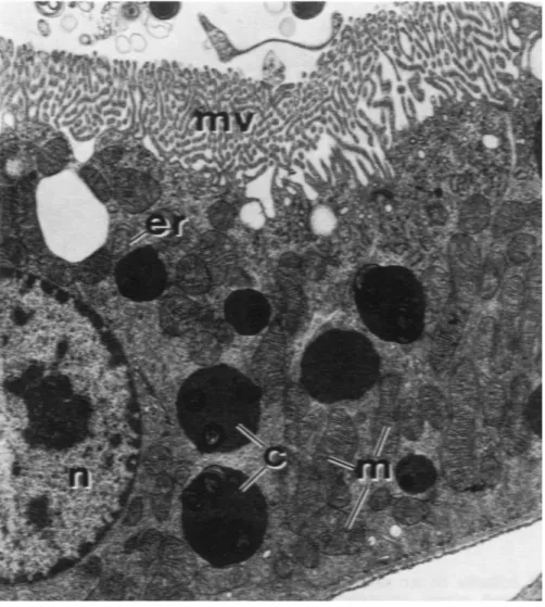 Figura 10. Microscopía electrónica de un túbulo proximal de una rata recibiendo gentamicina a 40  mg/kg/día por 3 días