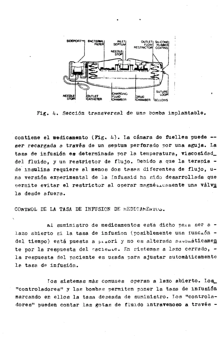 Fig.  4.  Sección  t r a n e v e r m l   de  una  bomba  implantable. 