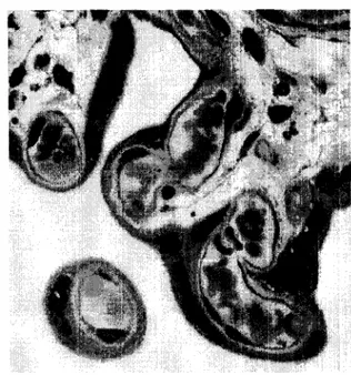 Fig.  1.  Corte  de  una  vellosidad  coriónica  donde  se  puede  observar  F:  fibroblasto,  E:  eritrocitos,  Ca:  capilar,  Ct:  citotrofoblasto