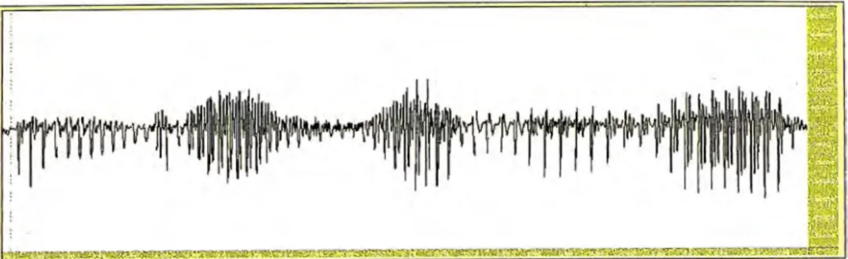 Figura 3.1: La figura muestra la señal de voz vista a lo largo del tiempo 