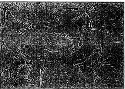 Fig. 4  Espermatozoides de Cerdo.  En  la  imagen  se muestran  los  espermatozoides de cerdo teflidos  con Eosina-Y