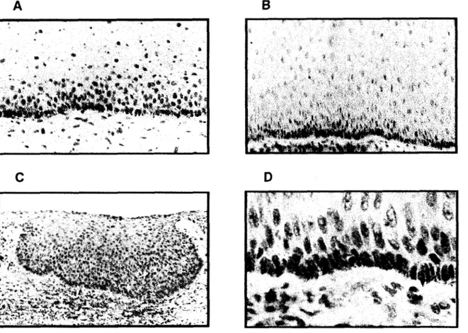 Figura  7.  Detecci6n  in  situ de  transcritos  HOXB3 y  B13  en  epitelio  cervical  normal