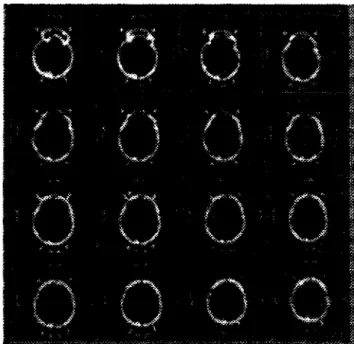 Figura A3.9  Cortes  helicoidales 