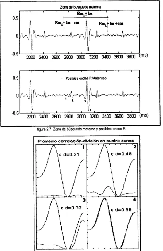 figura 2.7  Zona de búsqueda  materna  y  posibles  ondas  R 