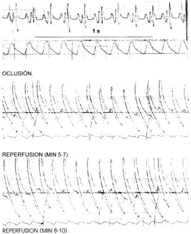 Figura 1 1   B.  Trazos  representativos  de electrocardiogramas  y  señal de presión  en  la arterial  femoral de ratas  HTG  machos que recibieron  Ketorolac