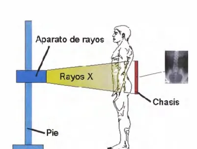 Figura N º  2.2 Equipo rayos X convencional 