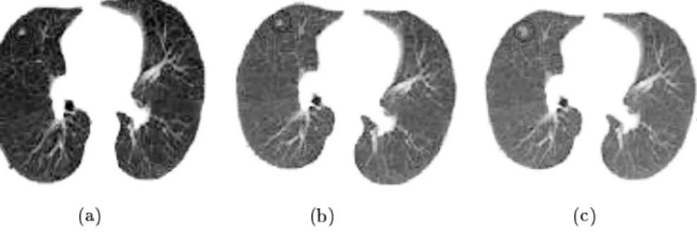 Figure 1.16: (a) CT scan June 2000 (b) CT scan June 2001 (c) CT scan June 2002. 0 5 10 15 20 25 300.10.20.30.40.50.60.70.80.9I(α) Generation number  Figure 1.17: MI ﬁtness function at different GA iterations.
