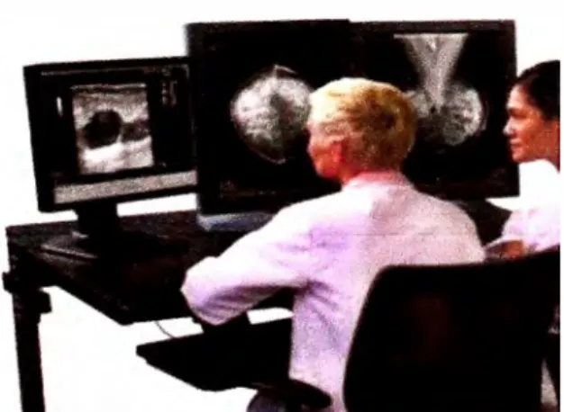 Figura  N º  07:  Mamografía  visualizada en estación de diagnóstico. 