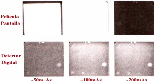 Figura  N º  2.5:  Respuesta  de  un  sistema  película  mamográfica/pantalla  de  fosforo  (fila  superior)  y  de  un  detector  digital  directo  (fila  inferior)  ante  tres  exposiciones  diferentes