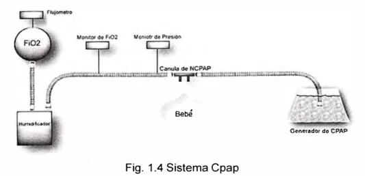 Fig. 1.4 Sistema Cpap 