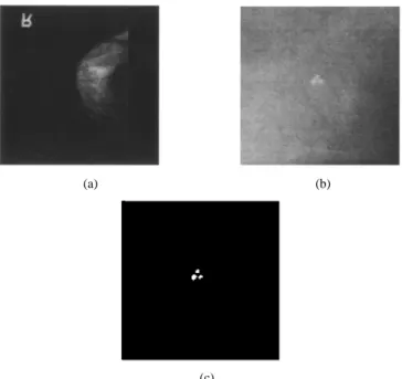 Fig. 2. Flow chart of our CAD system for the automatic detection of clustered microcalcifications in digitized mammogram films.