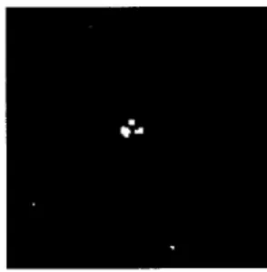 Fig. 7. The thresholded likelihood map of the mammogram in Fig. 1(b).