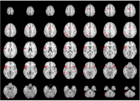 Table 2 presents the main loci of brain connectivity of insula by Meta-analytic Connectivity Modeling (MACM)