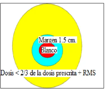 Figura 20: Se muestra unas estructuras en forma circular para representar: el tumor o  banco tumoral (color rojo), margen de 1,5 cm (celeste), órgano sano (amarillo) y la dosis 