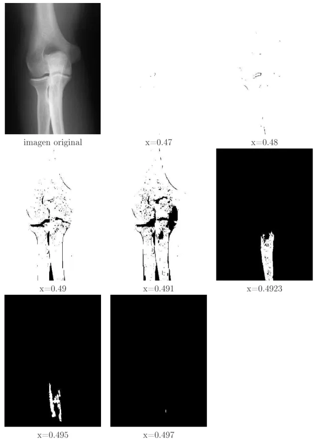 Figura 6.5: Segmentación: radiografía del codo