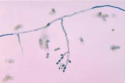 Figura 2. Cladosporium spp en forma microscópicamente  presenta  hifas  finas,  septadas,  ramificadas  de  color  hialino  a  marrón, sostenidas  por  cadenas  ramificadas  de  conidios cilíndricos