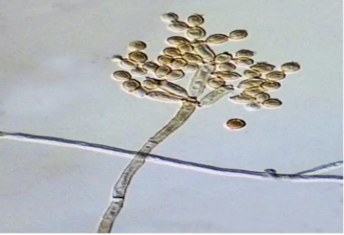 Figura  3.  Morfología  microscópica  de  Cladosporium  cladosporioides:  conidios  que  generalmente  quedan  en  cadenas  acrópetas,  con una coloración marrón