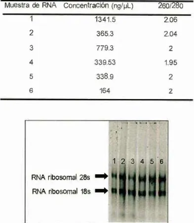 Tabla  2.  Cuantificación  del  RNAt  de  las  muestras  Control  (C)  de  ventriculo  izquierdo