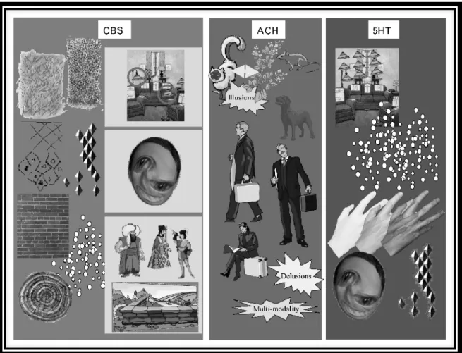 Tabla	
  1:	
  Representaciones	
  de	
  síndromes	
  de	
  alucinaciones	
  visuales:	
  XXXXX	
  (Síndrome	
  de	
  Charles	
  Bonnet	
   (CBS)),	
  colinérgico	
  (ACH)	
  y	
  serotonérgico	
  (5HT)
