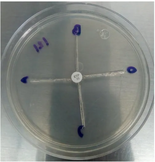 Figura 12. Placa sin inocular. 