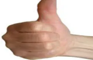 Figura 2: Signo de vale.  