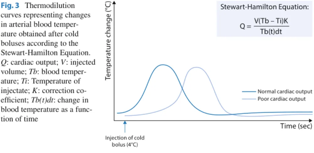 Fig. 3 Thermodilution curves representing changes in arterial blood  temper-ature obtained after cold boluses according to the Stewart-Hamilton Equation.
