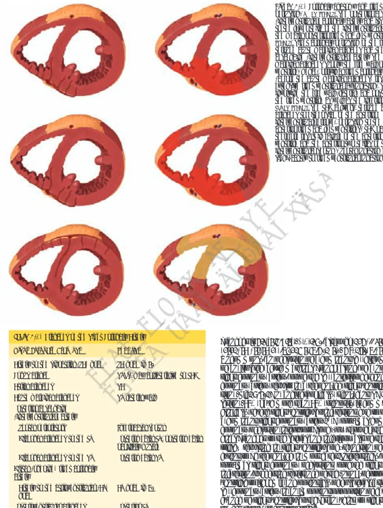 Figure 6-1.  Coronary anatomy and right ventricular  perfusion. UPPER IMAGES, The posterior descending  (interventricular) coronary artery and its blood supply  to the lower third of the interventricualr septum and  the medial posterior right and left vent