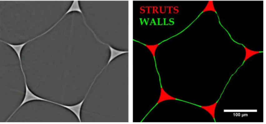 Figure 2-12.  Tomographic  slice  –left-  and  separation  in walls  and struts  –right-  of  a  PU  foam  with f s   of 0.7