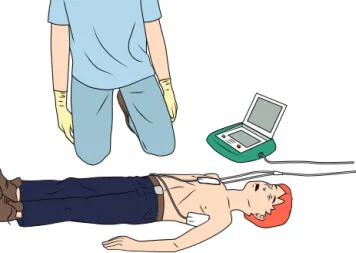 Fig. 1.24. Paddle positions for deﬁbrillation – child.