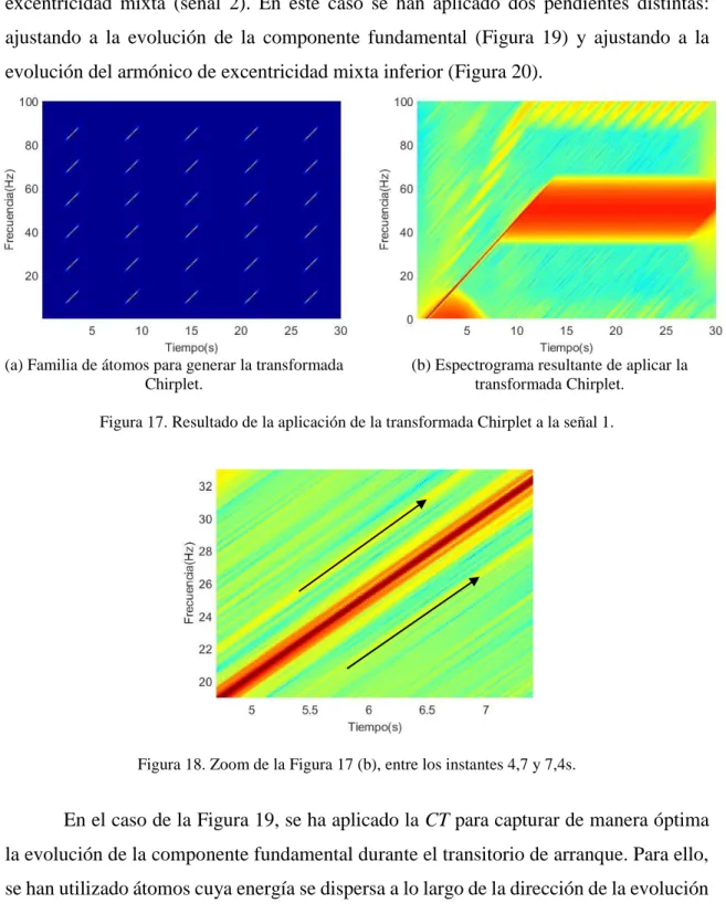 Figura 17. Resultado de la aplicación de la transformada Chirplet a la señal 1. 