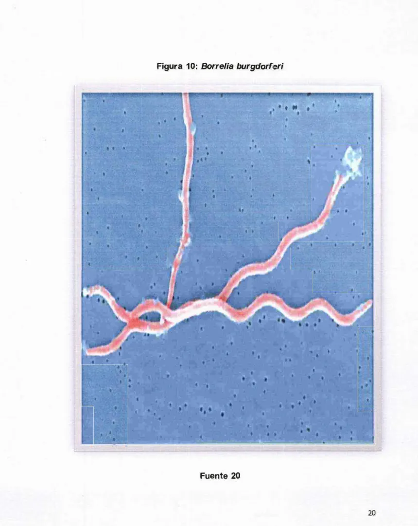 Figura  10:  Borrelia  burgdorferi  •  • •  • • • • • t • • • • • .. • ' t • ' t • • ' • • • • • • • • •  ' • • •  •  t  • • •  •  •  t  • ' •  •  •  •  •  •  • t  '  