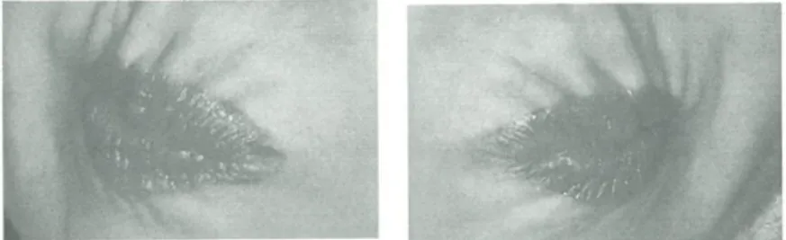 Fig. 12 Labios proyectados de izquierda a derecha. 