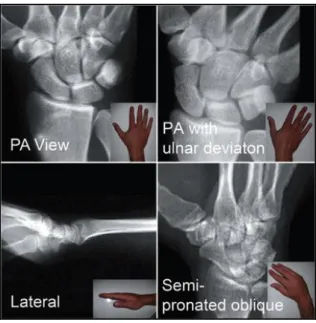 Figura 54: Radiografía con puño cerrado. 