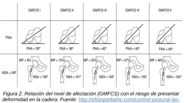 Figura 2. Relación del nivel de afectación (GMFCS) con el riesgo de presentar  deformidad en la cadera