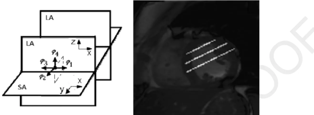 Fig. 2. The ﬁgure on the left sketches the proposed 3D HARP motion reconstruction scheme for the intersected points between SA and LA planes, which are shown in the  ﬁgure on the right over the SA