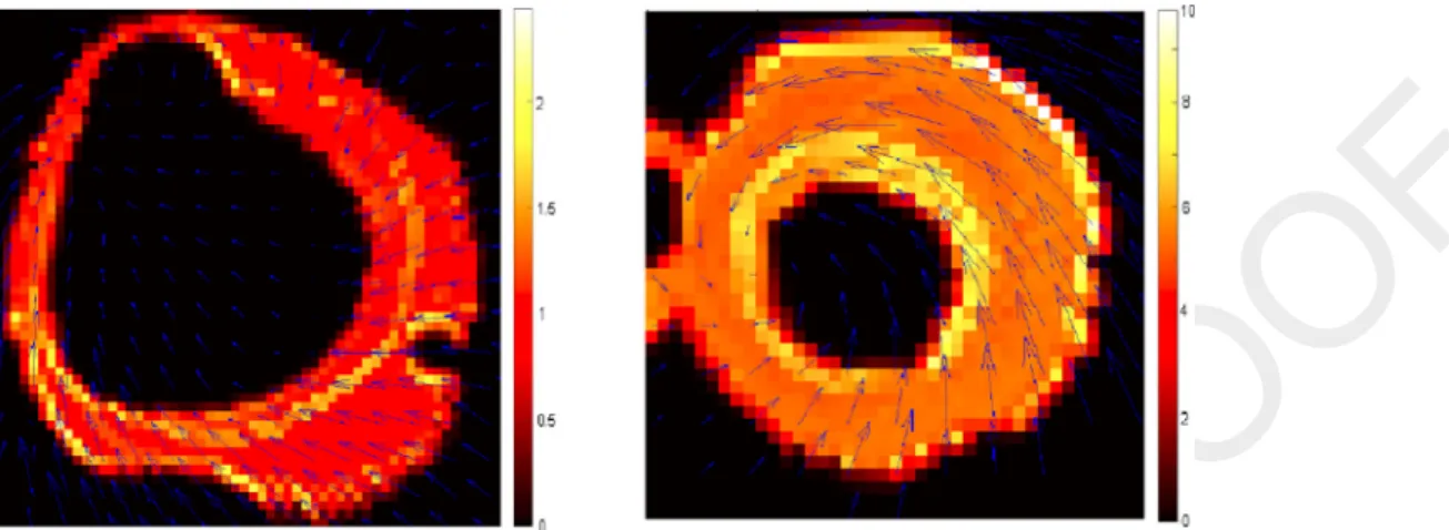 Fig. 3. Examples of vorticity vector modulus at ES from (9) in basal and apical slices, left and right respectively