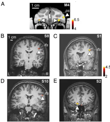 Table S2 gives the sizes of the 6 face patches in each of the 9 macaques. ML was the largest of the 6 patches, followed by AL, PL, MF, AM, and AF