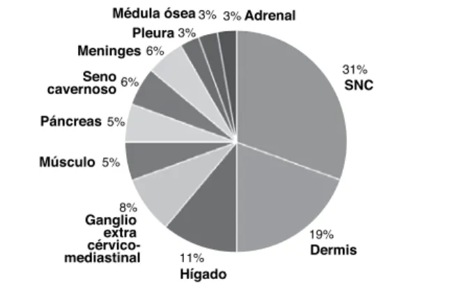 Gráfico 1 – Localización de las MI en 30 pacientes con CDT.