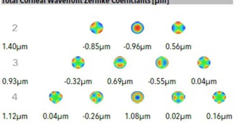 Figura 3: Coeficientes de frente de onda corneales tomados a partir de la  topografía de Scheimpflug, Galilei
