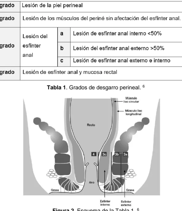 Tabla 1. Grados de desgarro perineal.  6