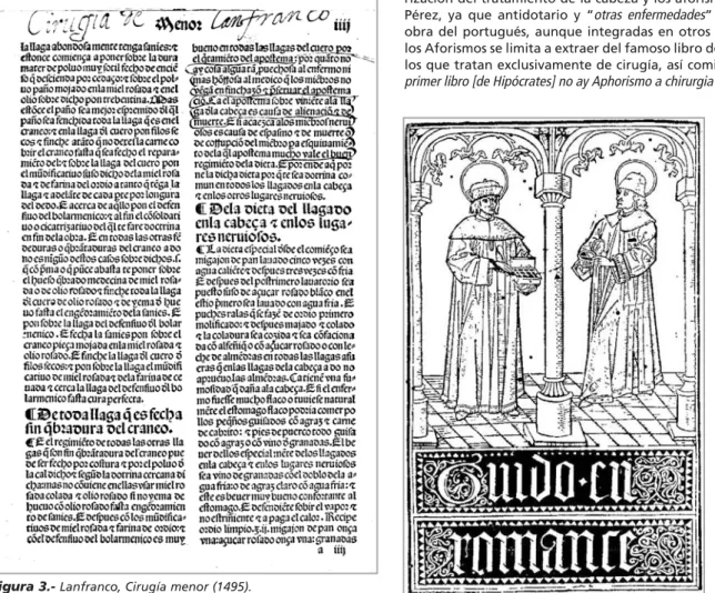 Figura 4.- 4.-Guido en romance (1498).