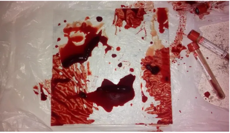 Figura 6. Sangre prueba 1 