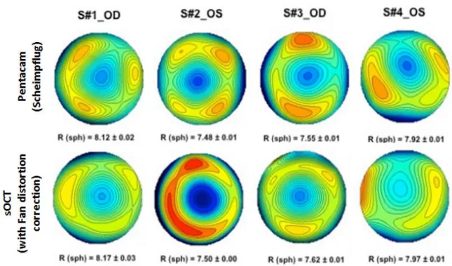 Figure  2.12  Corneal  elevation  maps  obtained  in  4  eyes  obtained  from  different  instruments  (relative to the best fitting sphere)